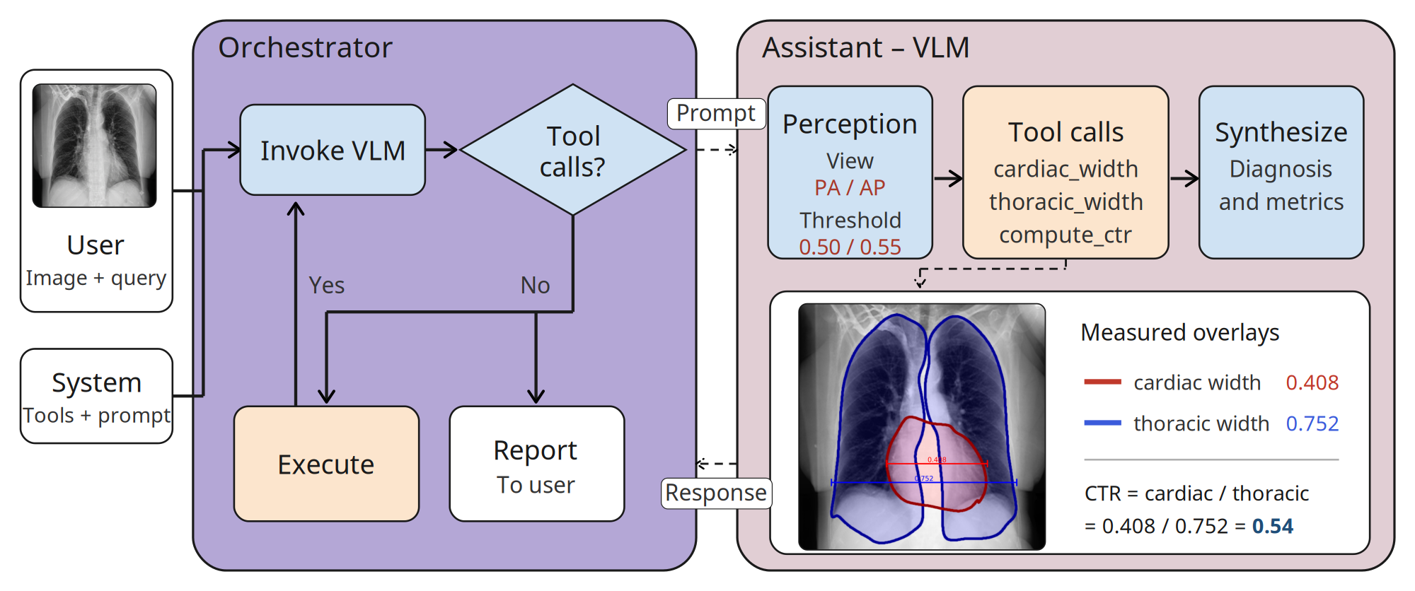 Diagram illustrating a workflow for a medical assistant using a vision-language model (VLM) to analyze chest X-ray images and provide diagnostic metrics. Key components include orchestrator handling prompts and tool calls, assistant performing perception and tool calls to measure cardiac and thoracic widths, and synthesizing diagnosis with visual overlays and calculated cardiothoracic ratio (CTR) displayed in red and blue.
